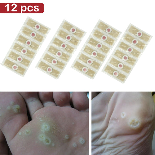 12pcs Medical Plasters Foot Corn Removal Warts Thorn patch  Curative Patches Calluses Callosity Detox Foot Pads Patches Medical