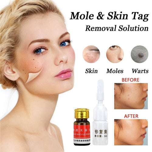 Face Wart Tag Freckle Removal Removal Cream Oil Mole Skin Tag Removal Solution Painless Mole Skin Dark Spot