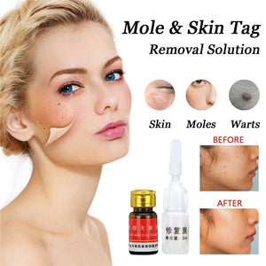 Face Wart Tag Freckle Removal Removal Cream Oil Mole Skin Tag Removal Solution Painless Mole Skin Dark Spot